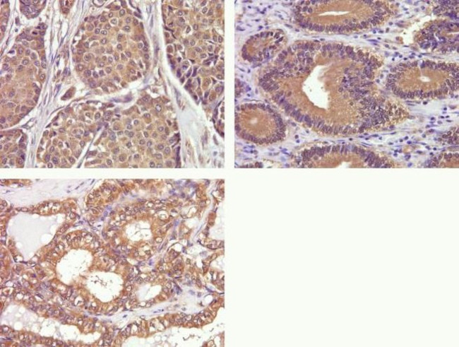 Phospho-FAK (Tyr397) Antibody in Immunohistochemistry (Paraffin) (IHC (P))