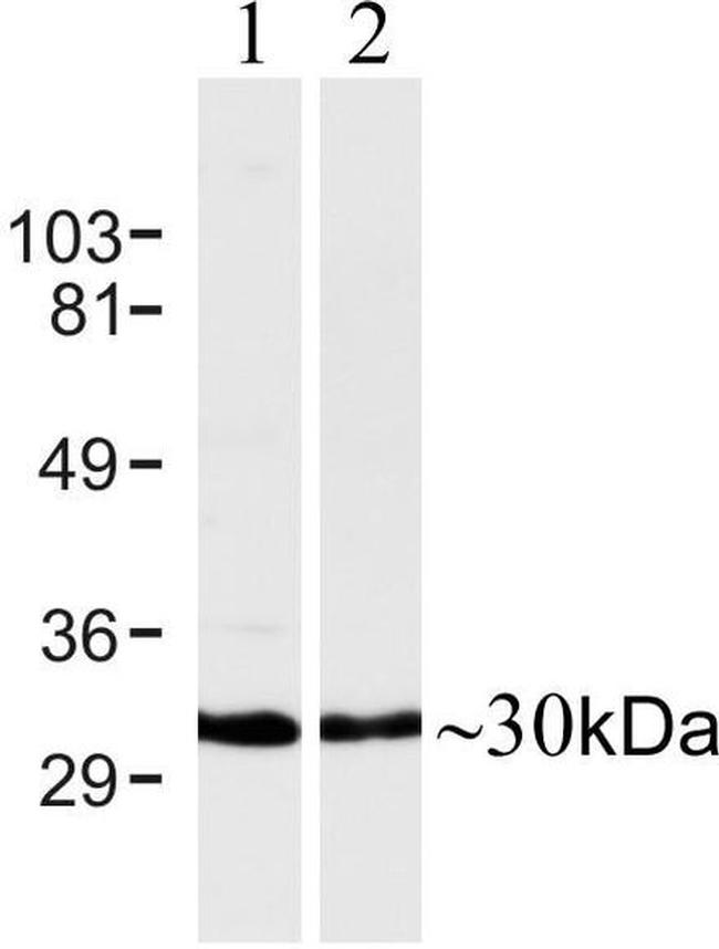 Connexin 30 Antibody in Western Blot (WB)