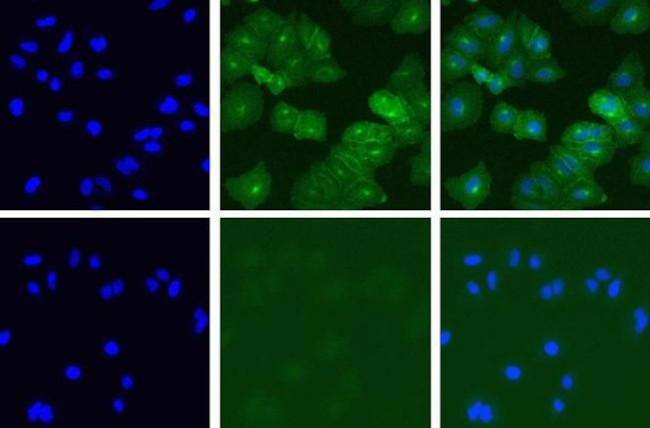 c-Met Antibody in Immunocytochemistry (ICC/IF)