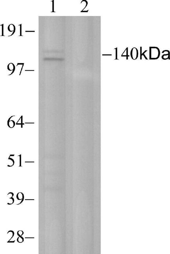 c-Met Antibody in Western Blot (WB)