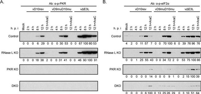 PKR Antibody in Western Blot (WB)