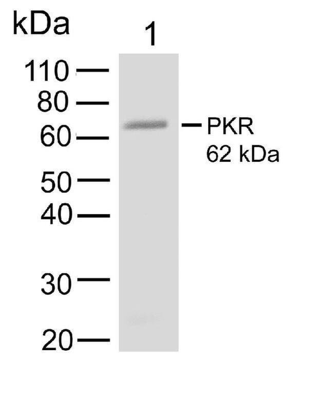 PKR Antibody in Western Blot (WB)