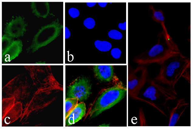 EGFR Antibody in Immunocytochemistry (ICC/IF)