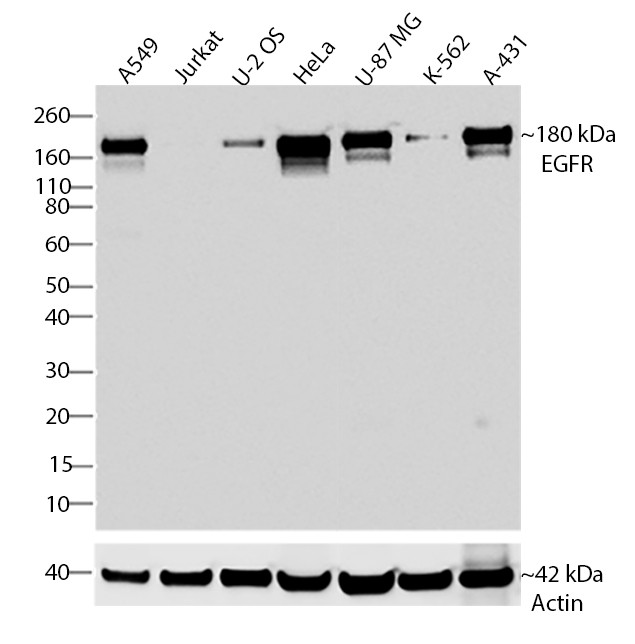 EGFR Antibody in Western Blot (WB)