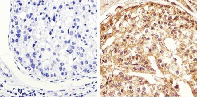 Phospho-STAT1 (Tyr701) Antibody in Immunohistochemistry (Paraffin) (IHC (P))