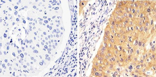 Phospho-STAT1 (Tyr701) Antibody in Immunohistochemistry (Paraffin) (IHC (P))