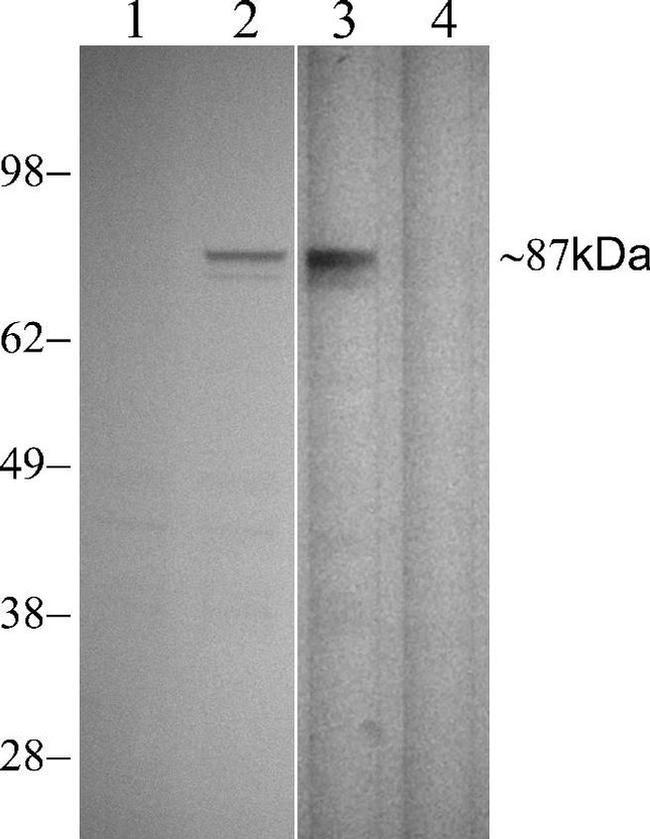 Phospho-STAT1 (Tyr701) Antibody in Western Blot (WB)