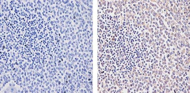 RIG-I Antibody in Immunohistochemistry (Paraffin) (IHC (P))