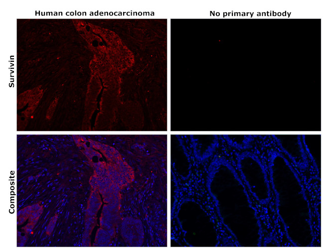 Survivin Antibody in Immunohistochemistry (Paraffin) (IHC (P))