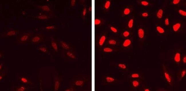 Phospho-p53 (Ser15) Antibody