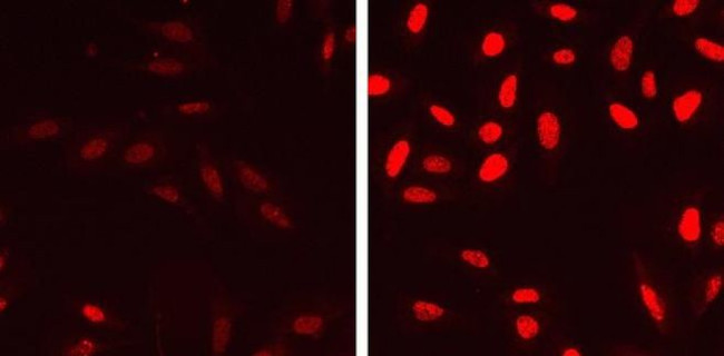 Phospho-p53 (Ser15) Antibody in Immunocytochemistry (ICC/IF)