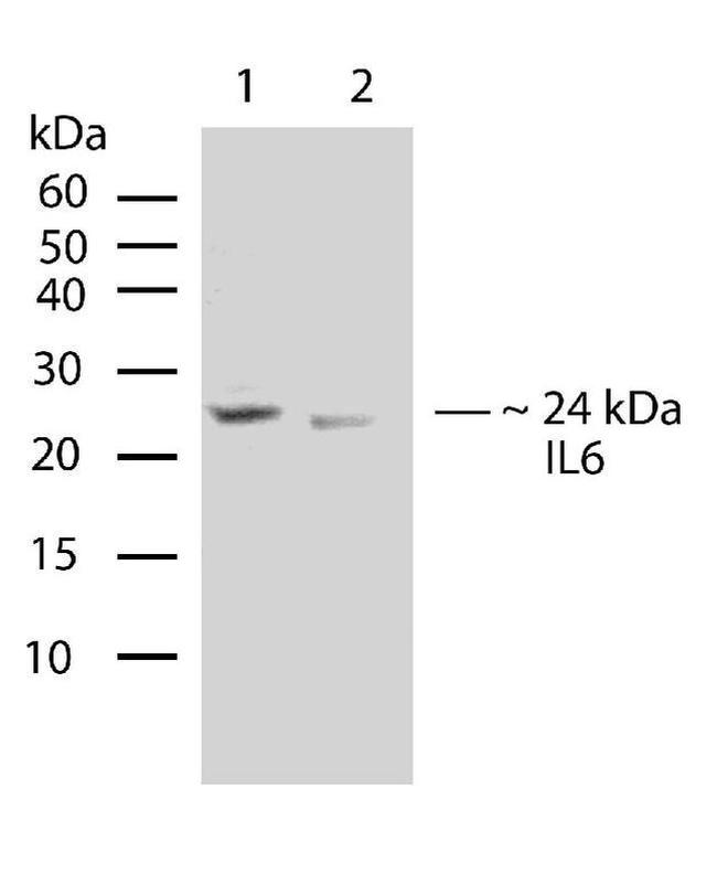 IL-6 Antibody in Western Blot (WB)