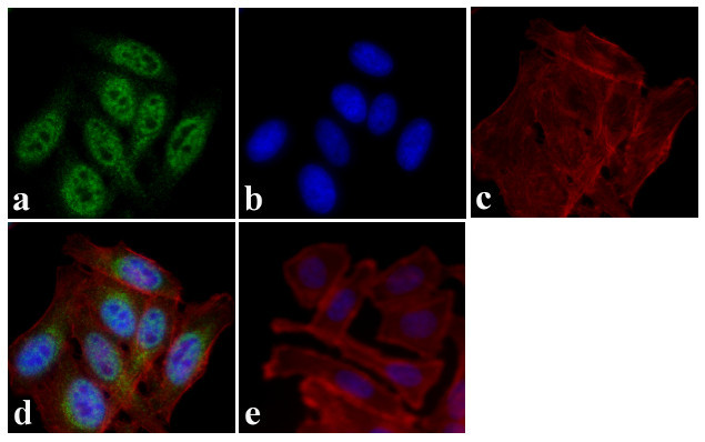 MDM2 Antibody in Immunocytochemistry (ICC/IF)