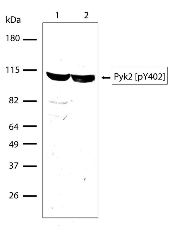 Phospho-PYK2 (Tyr402) Antibody in Western Blot (WB)