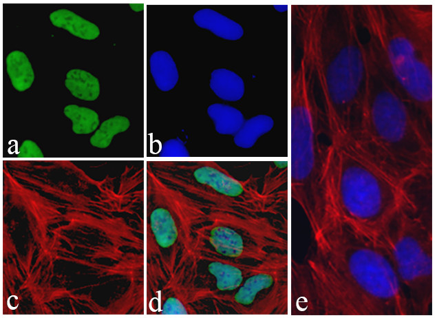 c-Myc Antibody in Immunocytochemistry (ICC/IF)