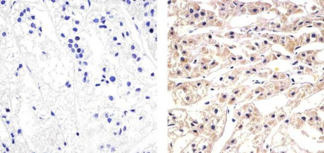 CXCL5 Antibody in Immunohistochemistry (Paraffin) (IHC (P))