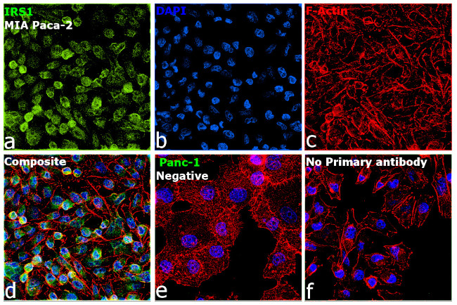 IRS1 Antibody in Immunocytochemistry (ICC/IF)