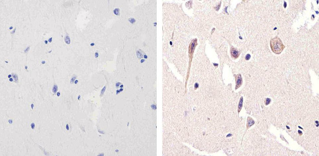 NMDAR1 Antibody in Immunohistochemistry (Paraffin) (IHC (P))