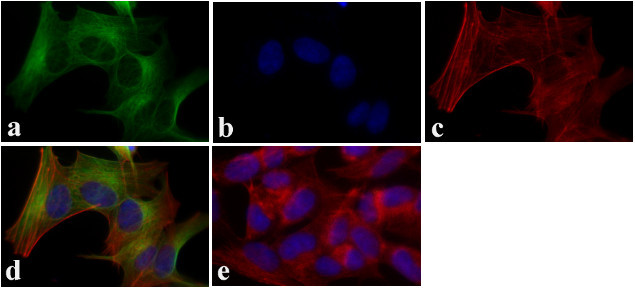 LC3B Antibody in Immunocytochemistry (ICC/IF)