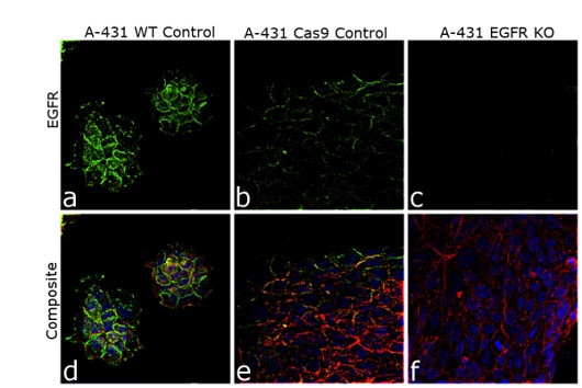 EGFR Antibody in Immunocytochemistry (ICC/IF)