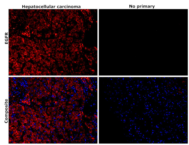 EGFR Antibody in Immunohistochemistry (Paraffin) (IHC (P))