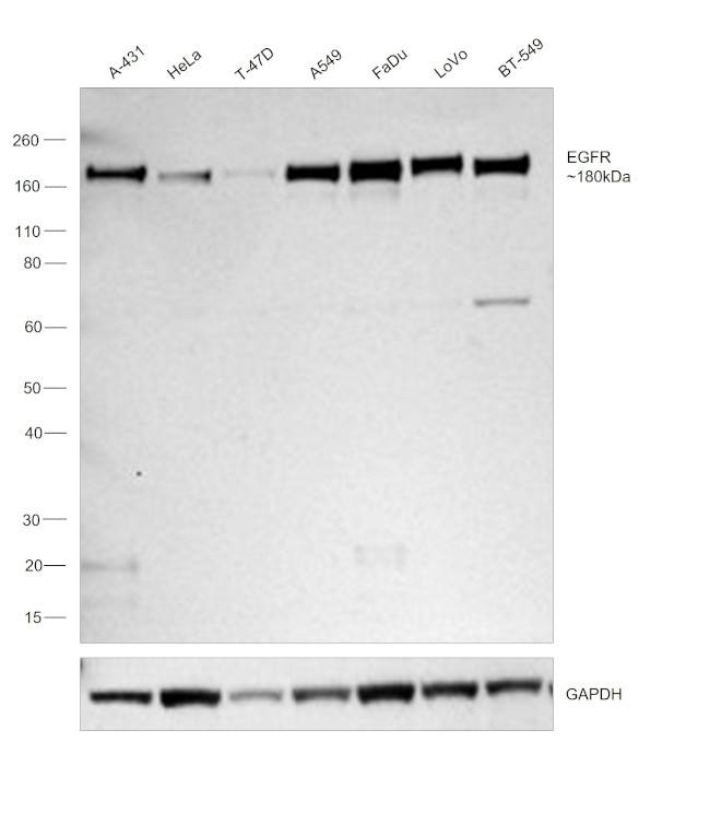 EGFR Antibody in Western Blot (WB)