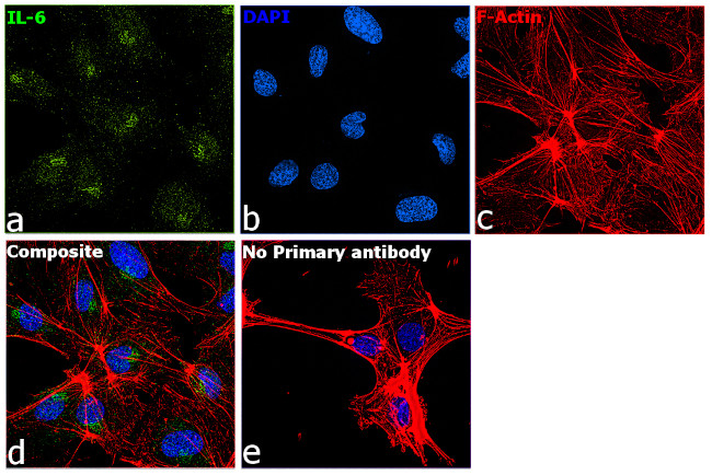 IL-6 Antibody in Immunocytochemistry (ICC/IF)