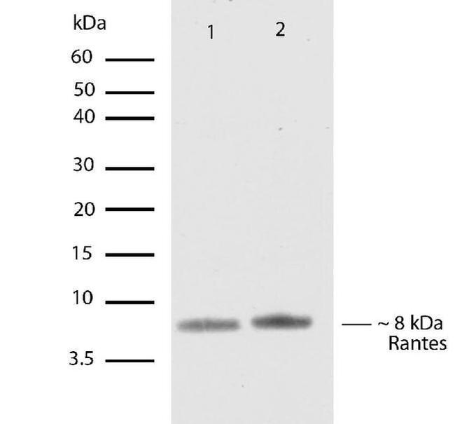 CCL5 (RANTES) Antibody in Western Blot (WB)