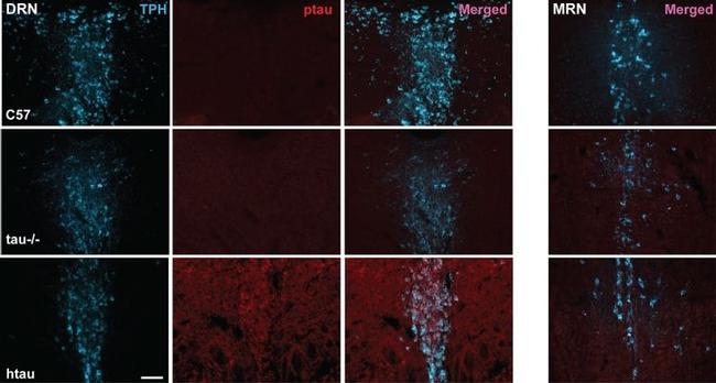 Phospho-Tau (Thr231) Antibody in Immunohistochemistry (Frozen) (IHC (F))