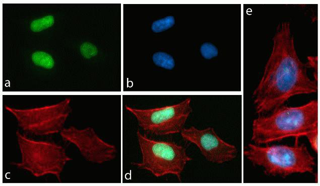 Phospho-Tau (Thr231) Antibody in Immunocytochemistry (ICC/IF)