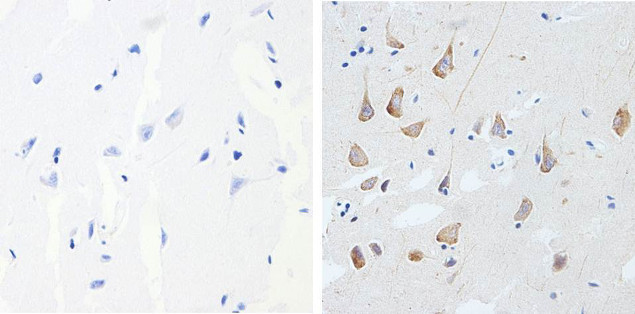 Phospho-Tau (Thr231) Antibody in Immunohistochemistry (Paraffin) (IHC (P))