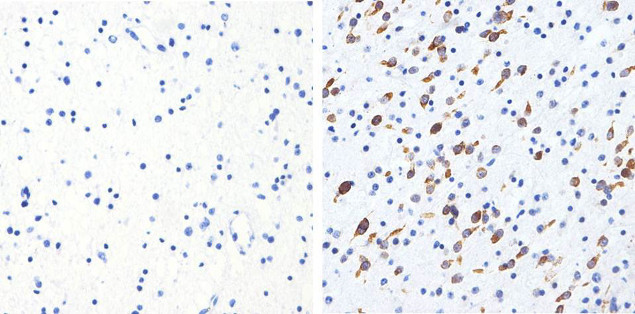 Phospho-Tau (Thr231) Antibody in Immunohistochemistry (Paraffin) (IHC (P))