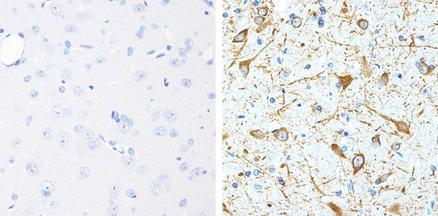 Phospho-Tau (Thr231) Antibody in Immunohistochemistry (Paraffin) (IHC (P))