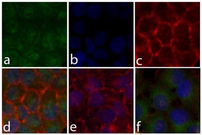 Phospho-STAT5 alpha (Tyr694) Antibody