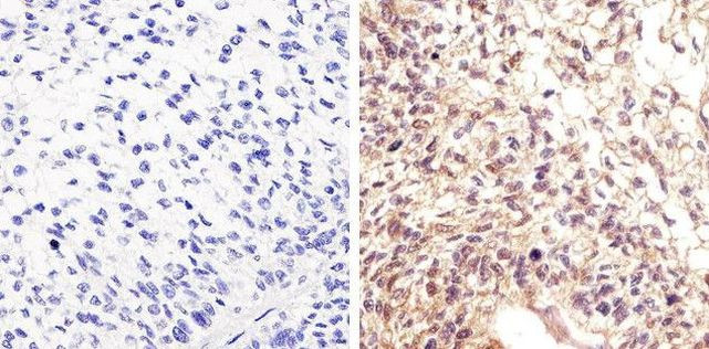 Phospho-STAT5 alpha (Tyr694) Antibody in Immunohistochemistry (Paraffin) (IHC (P))