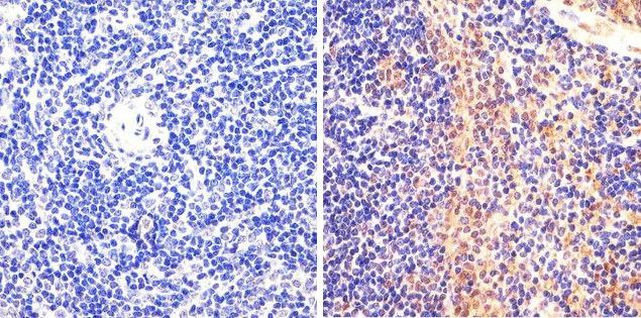 Phospho-STAT5 alpha (Tyr694) Antibody in Immunohistochemistry (Paraffin) (IHC (P))