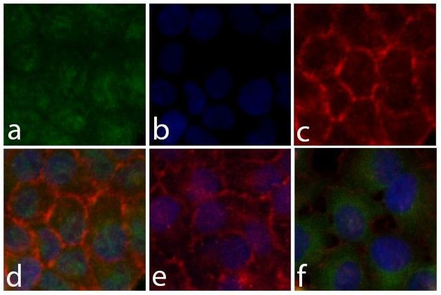 Phospho-STAT5 alpha (Tyr694) Antibody in Immunocytochemistry (ICC/IF)