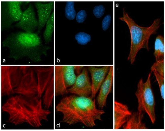 Phospho-p70 S6 Kinase (Thr389) Antibody in Immunocytochemistry (ICC/IF)