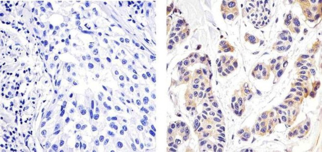 NFkB p65 Antibody in Immunohistochemistry (Paraffin) (IHC (P))