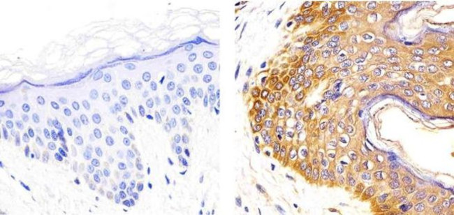 IL-2 Antibody in Immunohistochemistry (Paraffin) (IHC (P))