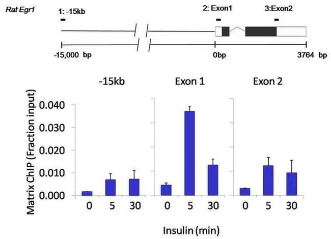 Phospho-p70 S6 Kinase (Thr421, Ser424) Antibody