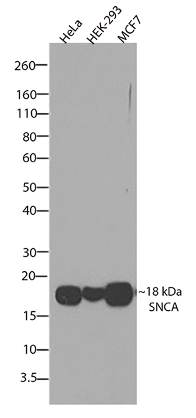 alpha Synuclein Antibody in Western Blot (WB)