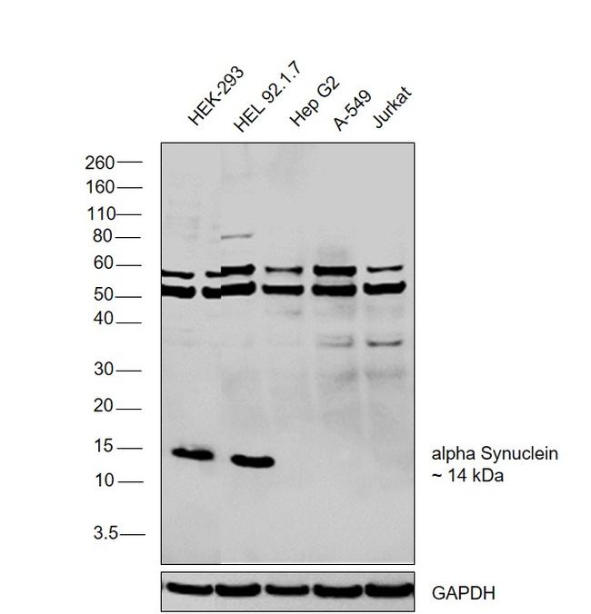 alpha Synuclein Antibody in Western Blot (WB)