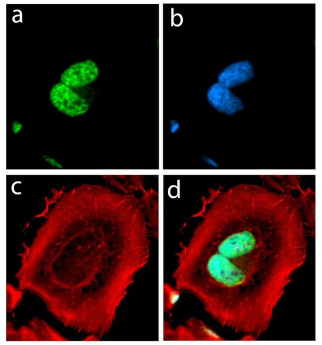 alpha Synuclein Antibody in Immunocytochemistry (ICC/IF)