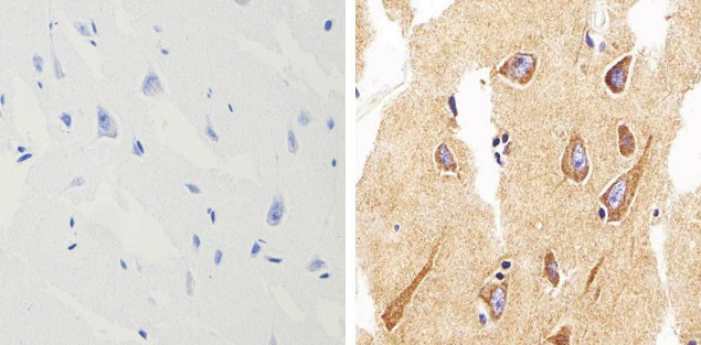 alpha Synuclein Antibody in Immunohistochemistry (Paraffin) (IHC (P))