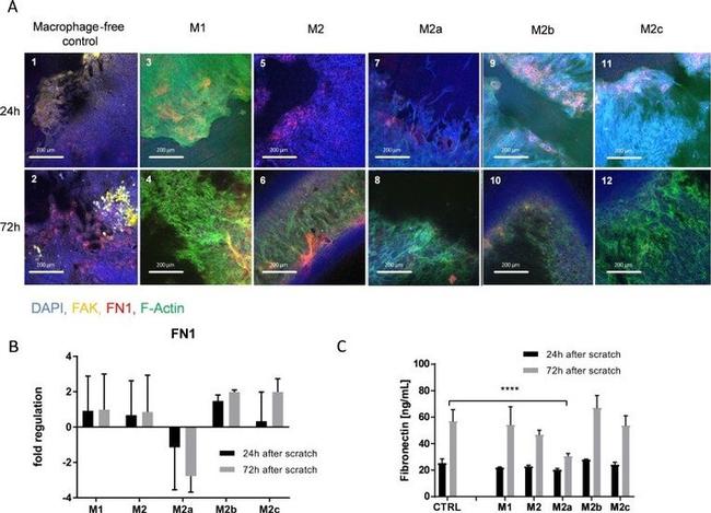 Fibronectin Antibody in Immunohistochemistry (IHC)