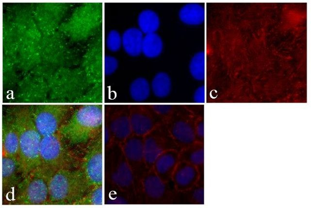 FAK Antibody in Immunocytochemistry (ICC/IF)