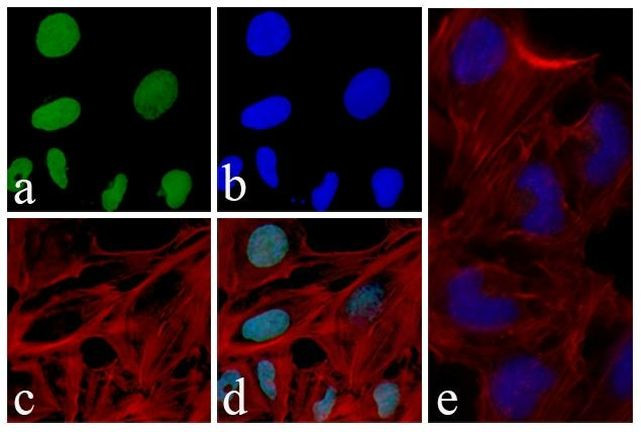 GSK3B Antibody in Immunocytochemistry (ICC/IF)