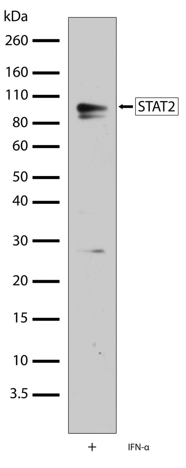 STAT2 Antibody in Western Blot (WB)