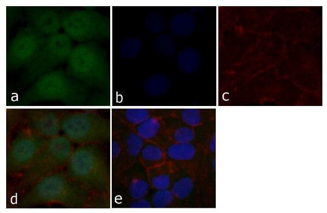 STAT5 beta Antibody in Immunocytochemistry (ICC/IF)